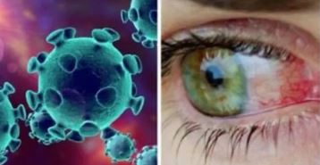 ԱՄՆ-ում թափ է հավաքում անբուժելի վիրուսային վարակը